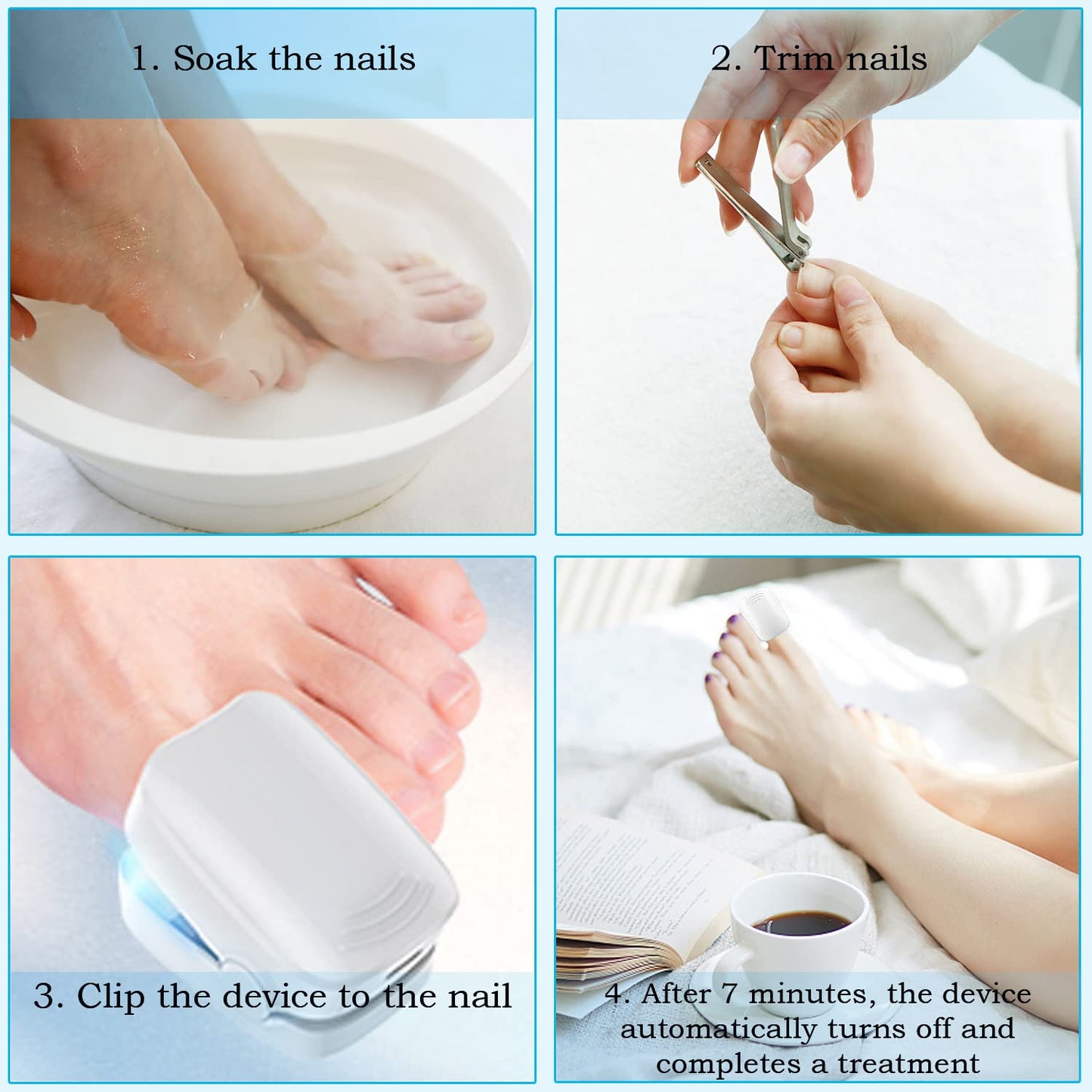 BEPHON Nail Fungus Cleaning Laser Treatment Device - Effective Home-Use Therapy for Damaged, Discolored, and Thickened Toenails and Fingernails with 910nm Infrared and 470nm Blue Light