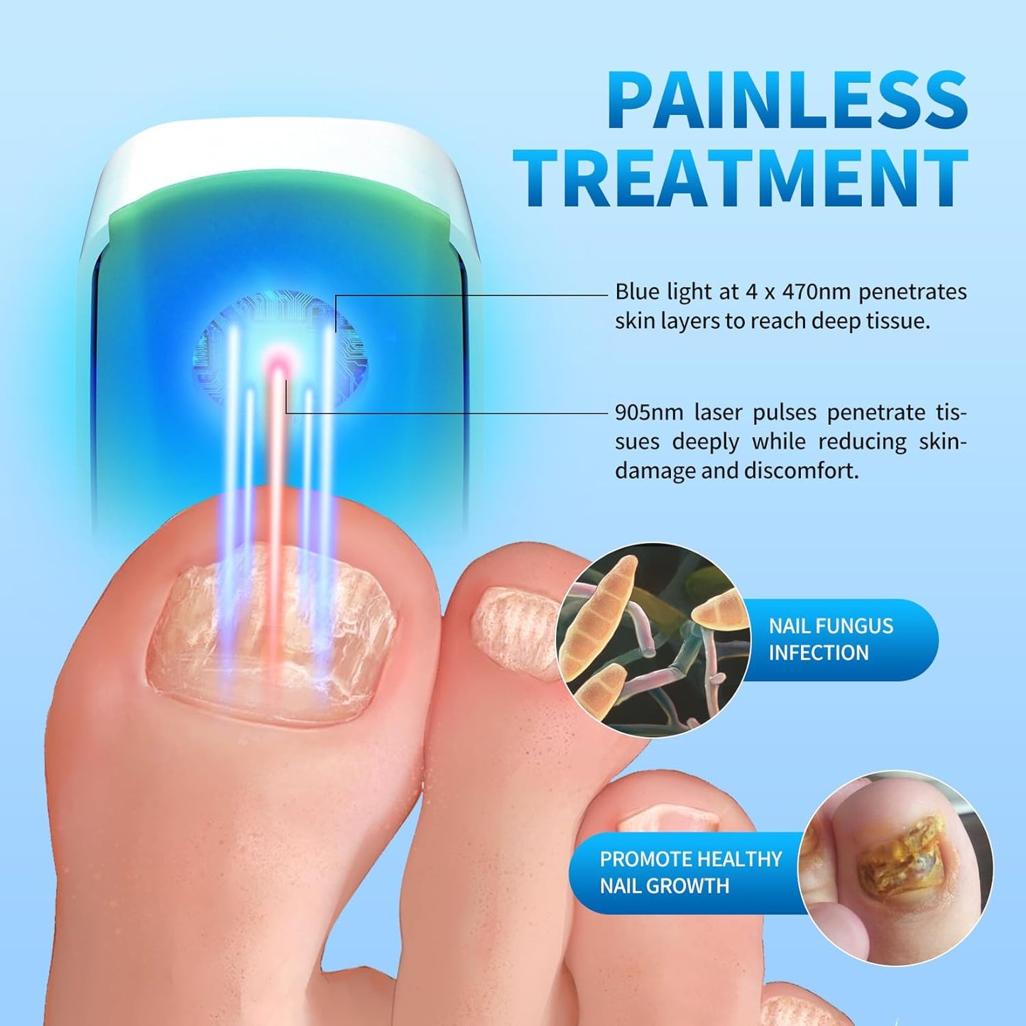 Glitreniee Nail Fungus Laser Treatment Device for Fingernails and Toenails, Rechargeable Nail Fungus Cleaning Laser Device with Digital Led Display, Effective Nail Light Treatment for Home Use (White)