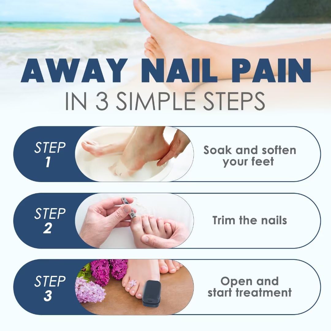 BORELTH Nail Fungus Laser Treatment LED Light Device, New Press Button-free Clip-on Design, Effective Convenient Nail Fungus Treatment for Toenails,Targets Damaged, Discolored and Thickened Toenails, Onychomycosis Buster